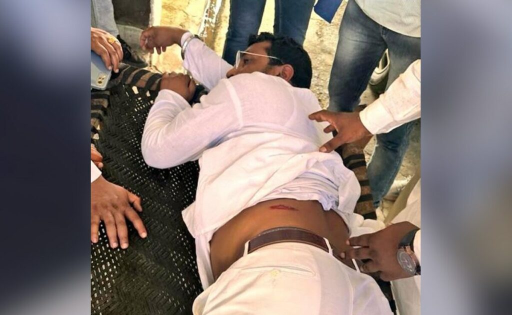 ಚಂದ್ರಶೇಖರ್ ರಾವಣ್ ಮೇಲೆ ದಾಳಿಯ ಮಹತ್ವದ ಸಾಕ್ಷಿ ಪತ್ತೆ