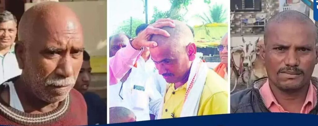 ಮಹಾರಾಷ್ಟ್ರ: ಪಡಿತರ ಗೋದಿಯಲ್ಲಿ ಹೆಚ್ಚಿನ ಸೆಲೆನಿಯಂನಿಂದ ಬುಲ್ದಾನಾದಲ್ಲಿ ಸಾಮೂಹಿಕ ಕೂದಲು ಉದುರುವಿಕೆ!